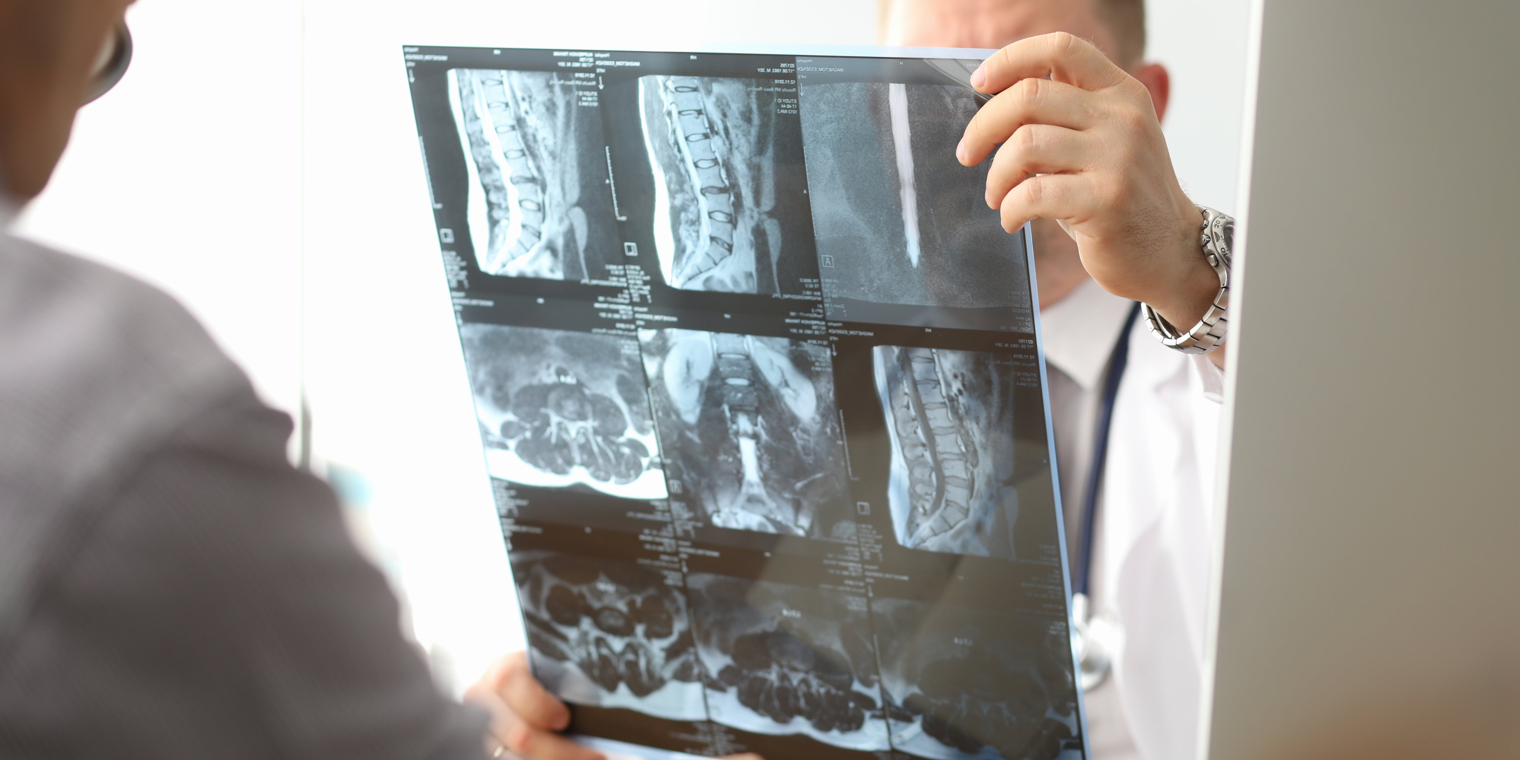 Hemp Protein Powder for Bone Health: How It Supports Bone Density and Strength