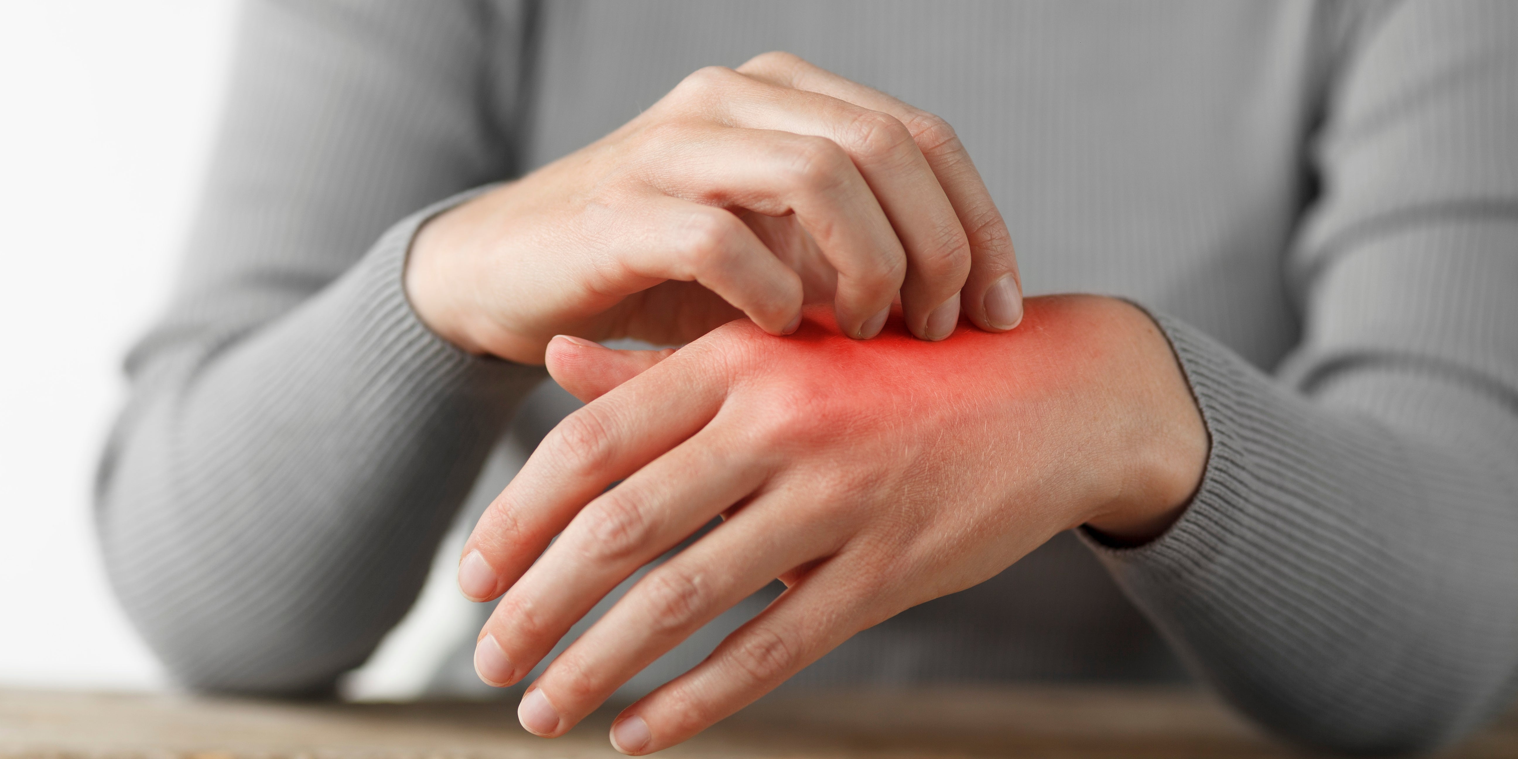 How Hemp Skincare Reduces Redness and Soothes Irritated Skin